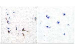 Immunohistochemical analysis of paraffin-embedded human brain tissue using Potassium Channel Kv3. (Kv3.2b Potassium Channel Antikörper  (C-Term))