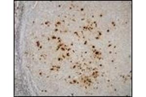 Immunohistochemistry (IHC) image for anti-Epstein-Barr Virus (EBV) (Internal Region) antibody (ABIN870464) (EBV Antikörper  (Internal Region))