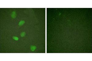 TNF-a - +Immunofluorescence analysis of HeLa cells, treated with TNF-a (20nM, 15mins), using HDAC3 (Ab-424) antibody. (HDAC3 Antikörper)