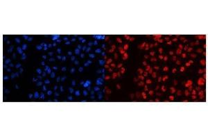 IF analysis of splicing factor 1 using anti-splicing factor 1 antibody (ABIN5692946). (Splicing Factor 1 Antikörper  (AA 160-266))