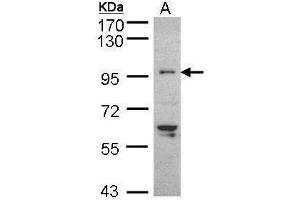 WB Image Sample (30 ug of whole cell lysate) A: HeLaS3 7. (TNNI3K Antikörper)
