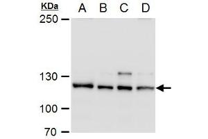 WB Image O-GlcNAc transferase antibody detects O-GlcNAc transferase protein by western blot analysis. (OGT Antikörper)