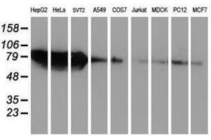 Image no. 2 for anti-Zinc Finger Protein 36, C3H Type, Homolog (Mouse) (ZFP36) antibody (ABIN1501406) (ZFP36 Antikörper)