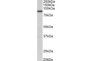 ABIN2562591 (1µg/ml) staining of A549 lysate (35µg protein in RIPA buffer). (FGFR1 Antikörper  (Internal Region))