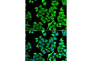 Immunofluorescence analysis of A549 cells using NAA50 antibody. (NAA50 Antikörper  (AA 1-169))