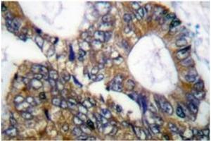 Image no. 1 for anti-Heat Shock 105kDa/110kDa Protein 1 (HSPH1) antibody (ABIN265469) (HSPH1 Antikörper)