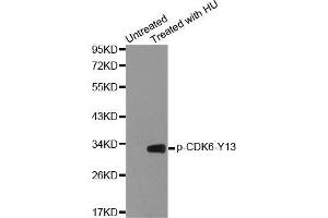 Western blot analysis of extracts from 293 cells using Phospho-CDK6-Y13 antibody. (CDK6 Antikörper  (pTyr13))