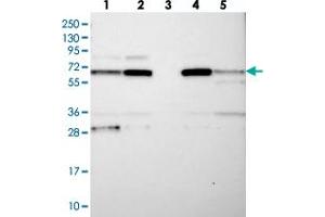 Western blot analysis of Lane 1: RT-4, Lane 2: U-251 MG, Lane 3: Human Plasma, Lane 4: Liver, Lane 5: Tonsil with CPEB4 polyclonal antibody  at 1:250-1:500 dilution. (CPEB4 Antikörper)