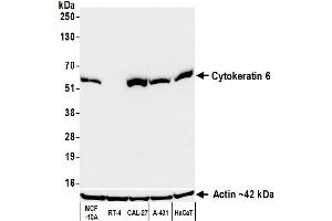 Western Blotting (WB) image for anti-Keratin 6 (KRT6) (C-Term) antibody (ABIN7795793)