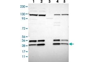 Western blot analysis of Lane 1: RT-4, Lane 2: U-251 MG, Lane 3: Human Plasma, Lane 4: Liver, Lane 5: Tonsil with SSR3 polyclonal antibody . (SSR3 Antikörper)