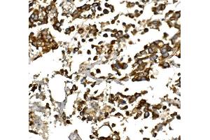 IHC analysis of IGF1 using anti-IGF1 antibody (ABIN7601895). (IGF1 Antikörper  (AA 50-118))