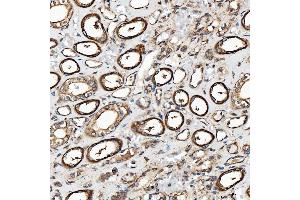 IHC analysis of SH2D4A using anti-SH2D4A antibody (ABIN7601695).