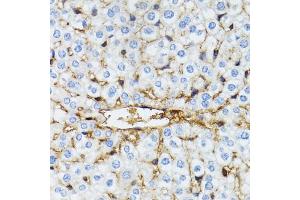 Immunohistochemistry of paraffin-embedded mouse liver using SERPING1 antibody (ABIN6290125) at dilution of 1:100 (40x lens). (SERPING1 Antikörper)
