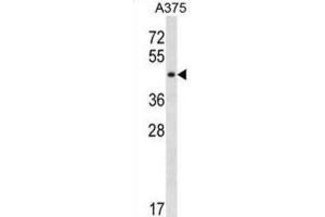 Western Blotting (WB) image for anti-SGT1, Suppressor of G2 Allele of SKP1 (SUGT1) antibody (ABIN3000456) (SUGT1 Antikörper)