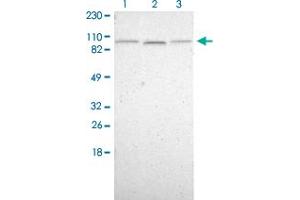 Western Blot (Cell lysate) analysis of (1) Human cell line RT-4, (2) Human cell line U-251MG sp and (3) Human cell line A-431.