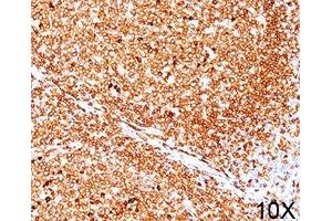 IHC testing of human tonsil (10X) stained with CD79a antibody (JCB117). (CD79a Antikörper  (AA 202-216))
