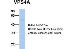 Host: Rabbit Target Name: VPS4A Sample Type: Human Fetal Heart Antibody Dilution: 1. (VPS4A Antikörper  (N-Term))