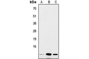 Western blot analysis of Insulin expression in A549 (A), mouse heart (B), rat liver (C) whole cell lysates. (Insulin Antikörper  (Center))