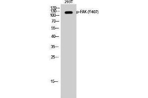 Western Blotting (WB) image for anti-PTK2 Protein tyrosine Kinase 2 (PTK2) (pTyr407) antibody (ABIN3179647) (FAK Antikörper  (pTyr407))