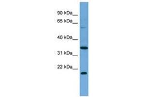 Image no. 1 for anti-Mesoderm Induction Early Response 1, Family Member 2 (MIER2) (C-Term) antibody (ABIN6745650) (MIER2 Antikörper  (C-Term))