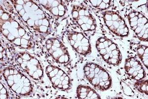 Immunohistochemistry of paraffin-embedded human colon using MSH2 Rabbit mAb (ABIN7268547) at dilution of 1:100 (40x lens). (MSH2 Antikörper)