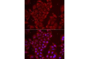 Immunofluorescence analysis of U2OS cells using TPP2 antibody. (Tpp2 Antikörper  (AA 1-300))