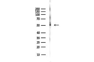 anti-UDP-N-Acteylglucosamine Pyrophosphorylase 1 (UAP1) (Internal Region) antibody