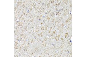 Immunohistochemistry of paraffin-embedded rat brain using [KO Validated] LC3B Rabbit pAb (ABIN6134220, ABIN6143470, ABIN6143475 and ABIN6215146) at dilution of 1:100 (40x lens). (LC3B Antikörper  (AA 1-100))