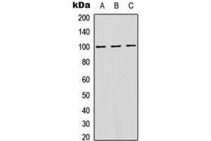 Western blot analysis of ATP1A1 (pS16) expression in HeLa (A), MCF7 (B), Raw264. (ATP1A1 Antikörper  (N-Term, pSer16))