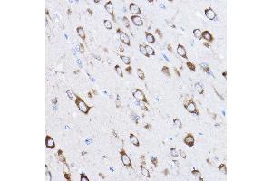 Immunohistochemistry of paraffin-embedded rat brain using RPL8 Rabbit pAb (ABIN6128659, ABIN6147155, ABIN6147156 and ABIN6214154) at dilution of 1:50 (40x lens).