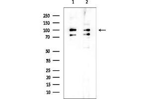 anti-ElaC Homolog 2 (ELAC2) (N-Term) antibody
