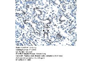 Human Lung (EVX1 Antikörper  (N-Term))