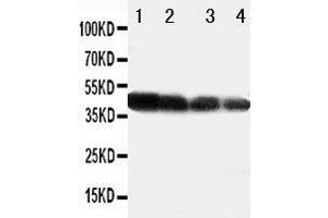 Anti-DLL3 antibody, Western blotting All lanes: Anti DLL3  at 0. (DLL3 Antikörper  (C-Term))