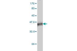 Western Blot detection against Immunogen (37. (RIPK4 Antikörper  (AA 675-784))