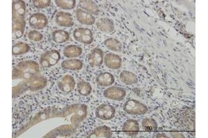 Image no. 2 for anti-N-Myc (And STAT) Interactor (NMI) (AA 1-101) antibody (ABIN598595) (NMI Antikörper  (AA 1-101))