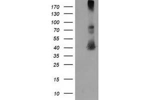 Western Blotting (WB) image for anti-Microtubule-Associated Protein, RP/EB Family, Member 2 (MAPRE2) antibody (ABIN1499315) (MAPRE2 Antikörper)