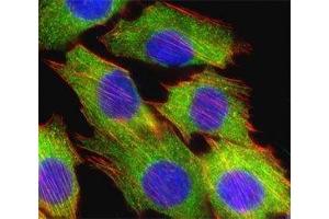 Fluorescent confocal image of C2C12 cell stained with AKT2 antibody at 1:25. (AKT2 Antikörper  (AA 452-481))