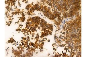 ABIN6262192 and ABIN6266561 at 1/100 staining human pituitary adenoma by IHC-P. (HDAC9 Antikörper  (C-Term))