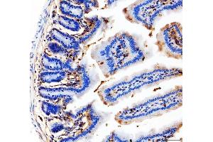 IHC analysis of CD31 using anti-CD31 antibody (ABIN5692990).