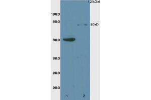 L1 rat liver lysates L2 rat brain lysates probed with Anti Mre11/HNGS1 Polyclonal Antibody, Unconjugated (ABIN747293) at 1:200 overnight at 4 °C. (Mre11 Antikörper  (AA 451-550))