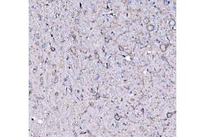 IHC analysis of FXR1 using anti-FXR1 antibody (ABIN7600093).