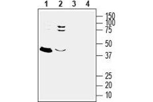 Western blot analysis of rat (lanes 1 and 3) and mouse (lanes 2 and 4) brain lysates: - 1,2. (Mesothelin Antikörper  (Extracellular))