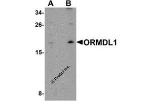 Western Blotting (WB) image for anti-ORM1-Like 1 (ORMDL1) antibody (ABIN1031784) (ORMDL1 Antikörper)