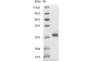 (Tris-Glycine gel) Discontinuous SDS-PAGE (reduced) with 5 % enrichment gel and 15 % separation gel.