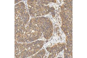 IHC analysis of Citrin/SLC25A13 using anti-Citrin/SLC25A13 antibody (ABIN7599512). (slc25a13 Antikörper  (AA 1-643))