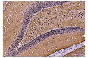 IHC analysis of CAMKIV/Camk4 using anti-CAMKIV/Camk4 antibody (ABIN7600419). (CAMK4 Antikörper  (AA 19-469))