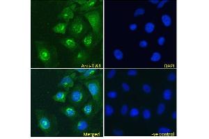 ABIN190808 Immunofluorescence analysis of paraformaldehyde fixed HeLa cells, permeabilized with 0.