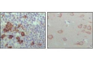 Immunohistochemical analysis of paraffin-embedded human lymph node (left) and brain (right), showing cytoplasmic localization with DAB staining using EhpB6 antibody. (EPH Receptor B6 Antikörper  (AA 601-750))