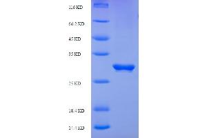 SDS-PAGE (SDS) image for Programmed Cell Death 1 (PDCD1) (AA 21-170) protein (His-SUMO Tag) (ABIN5711291)