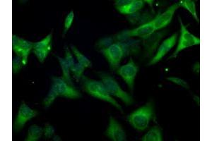 Image no. 6 for anti-Budding Uninhibited By Benzimidazoles 1 Homolog beta (Yeast) (BUB1B) antibody (ABIN1496996) (BUB1B Antikörper)